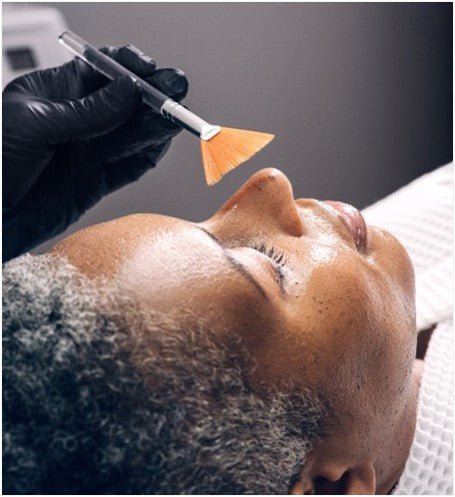 Facials & Chemical Peel Post-Care - Rajan Dermatology