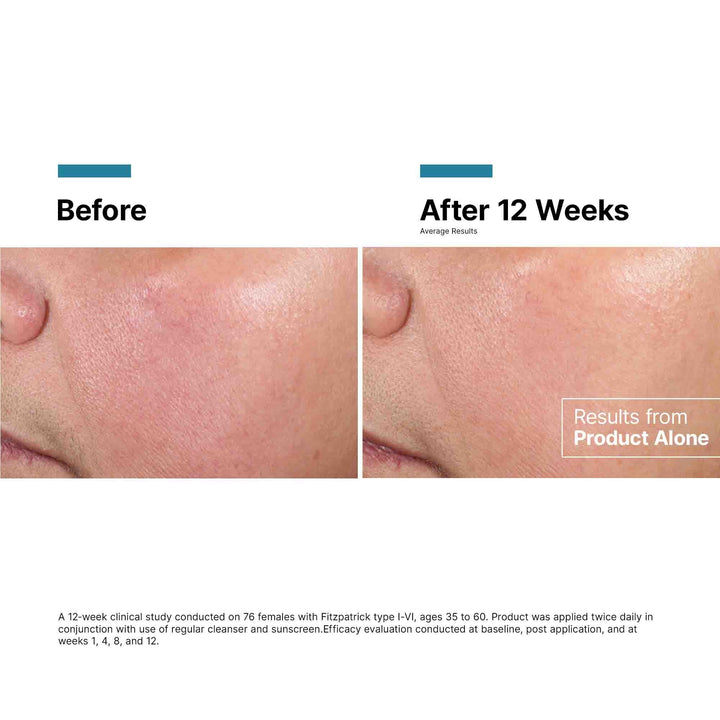 SkinCeuticals - SkinCeuticals Advanced RGN-6