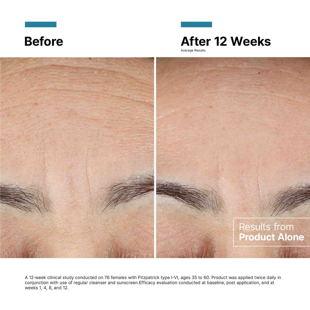 SkinCeuticals - SkinCeuticals Advanced RGN-6