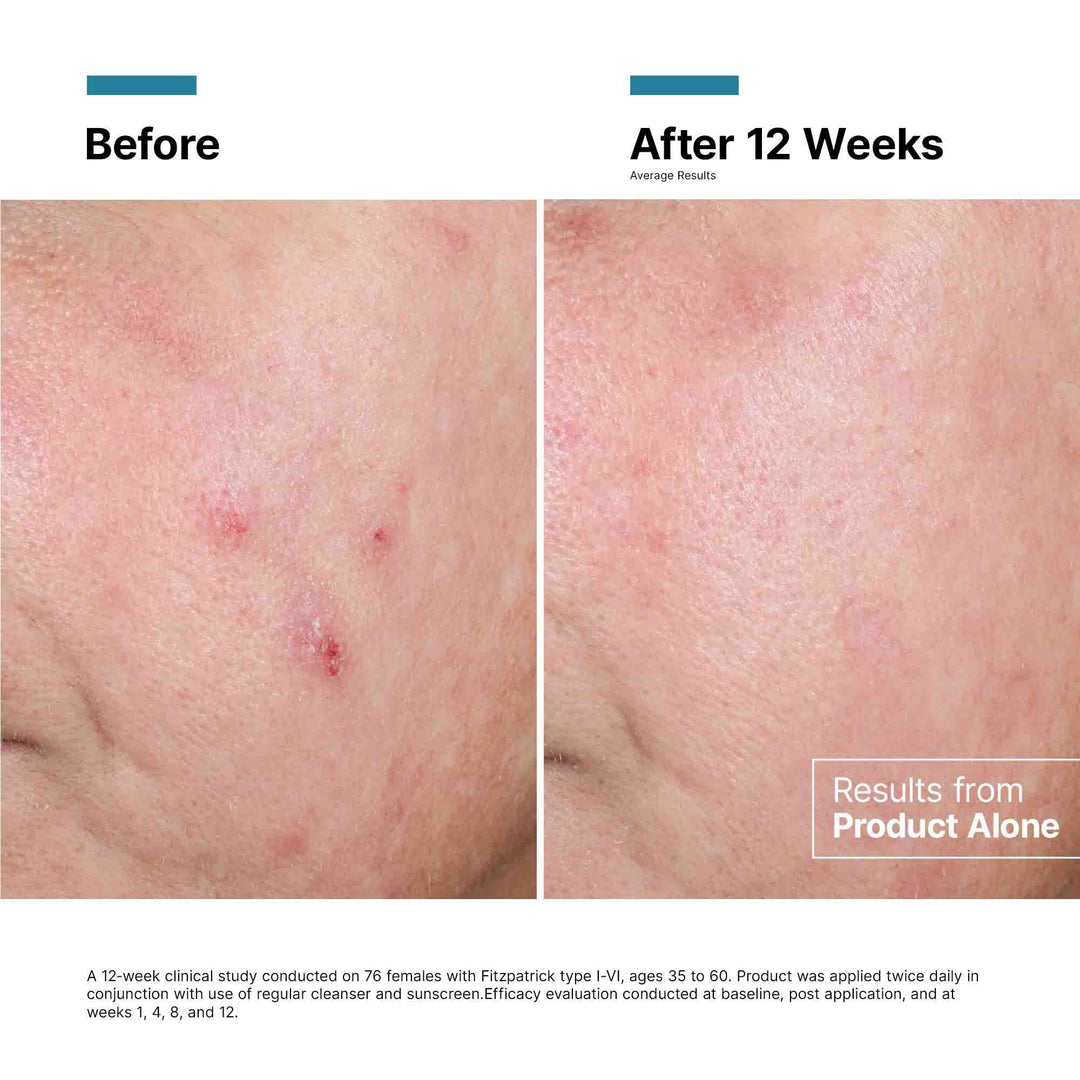 SkinCeuticals - SkinCeuticals Advanced RGN-6
