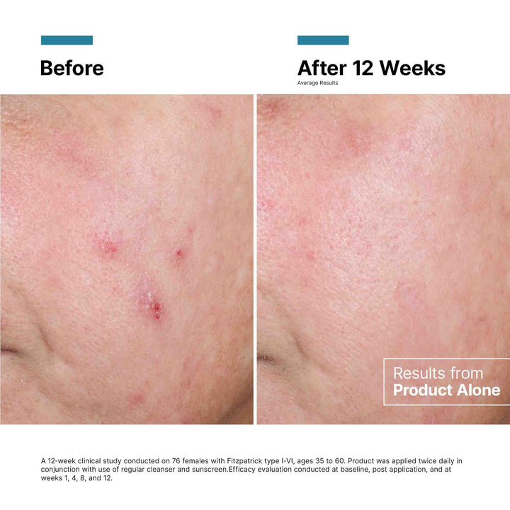 SkinCeuticals - SkinCeuticals Advanced RGN-6