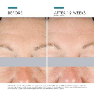 SkinCeuticals - A.G.E. Advanced Eye - 