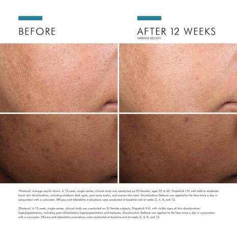 SkinCeuticals - Discoloration Defense - 