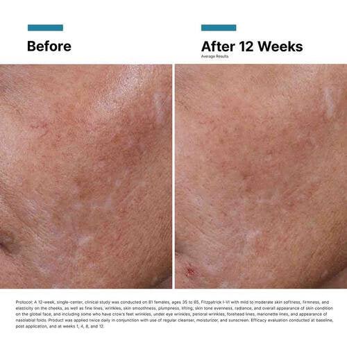 SkinCeuticals - Hyaluronic Acid (HA)Intensifier Multi - Glycan - 