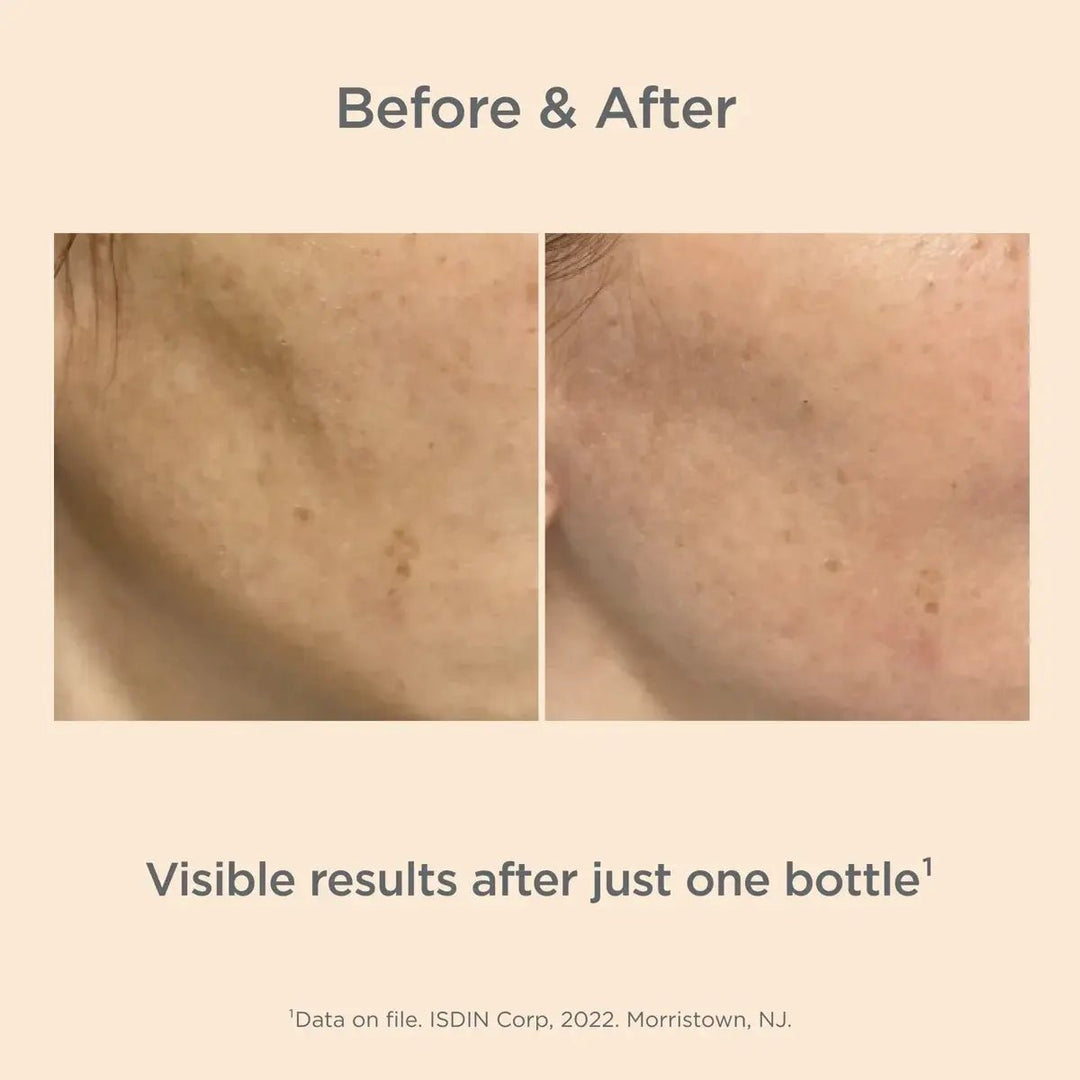 ISDIN - Melaclear Advanced - 