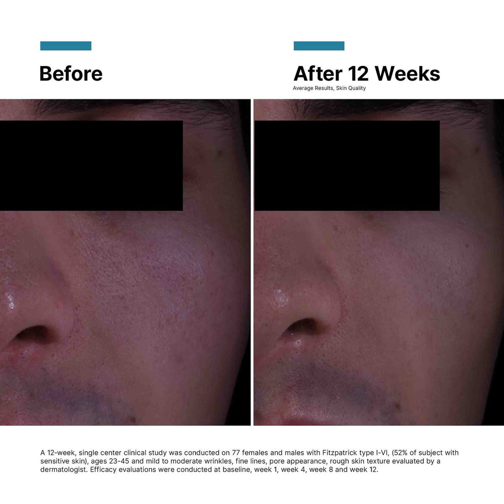 SkinCeuticals - P - TIOX Cream - 
