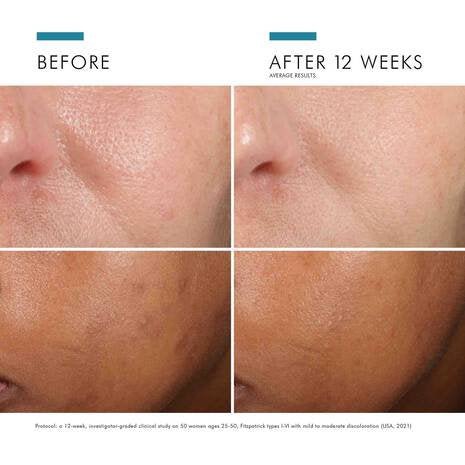 SkinCeuticals - Phloretin CF - 