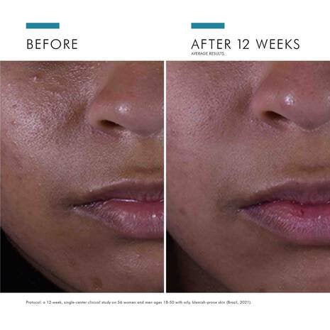 SkinCeuticals - Silymarin CF - 