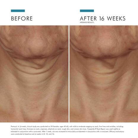 SkinCeuticals - Tripeptide - R Neck Repair - 